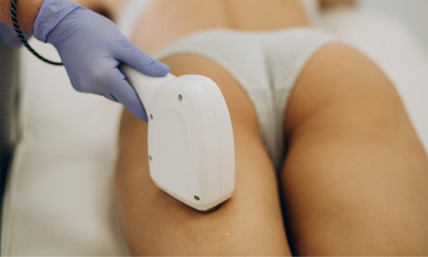 8 Benefits of EMS Sculpting