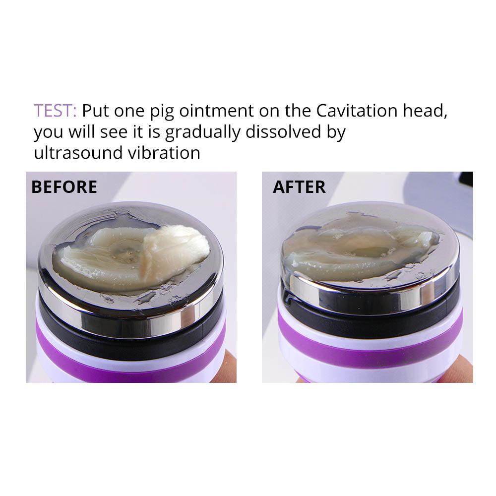 Cavitation Liposuction Machine