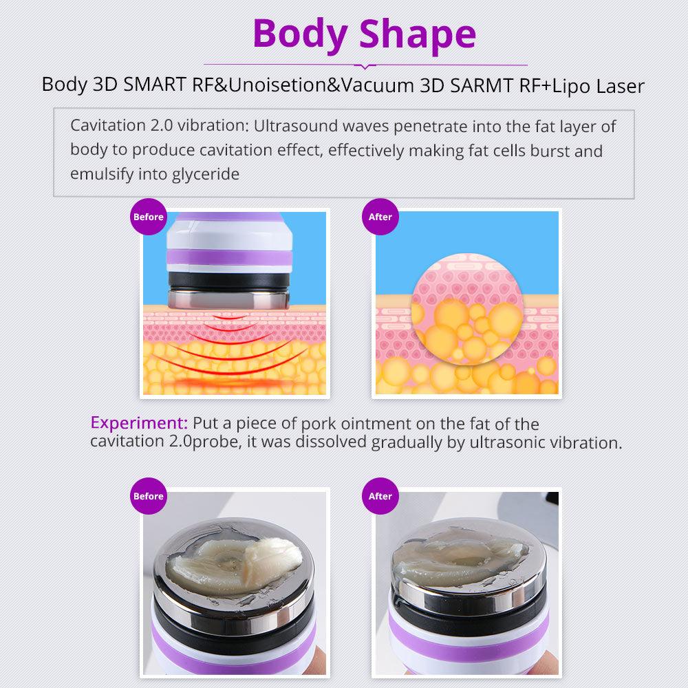 Cellulite Reduction Machine