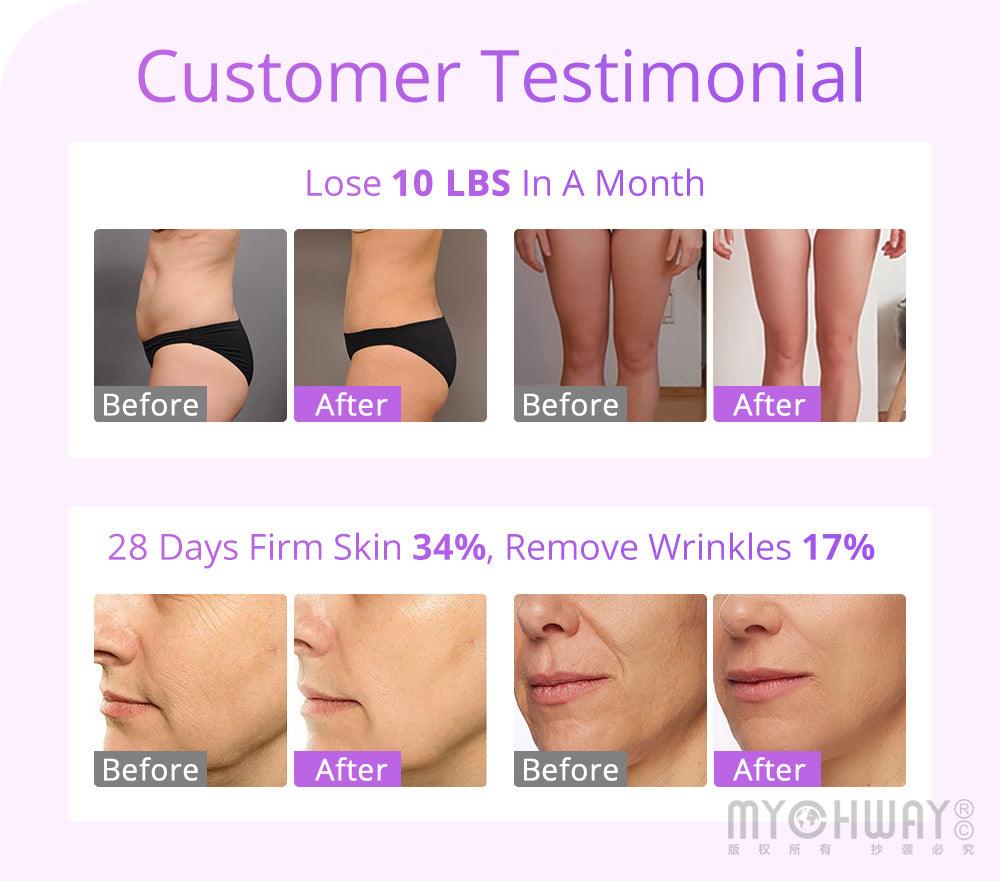 Face Lift 30 khz Cavitation Machine Customer Testimonial