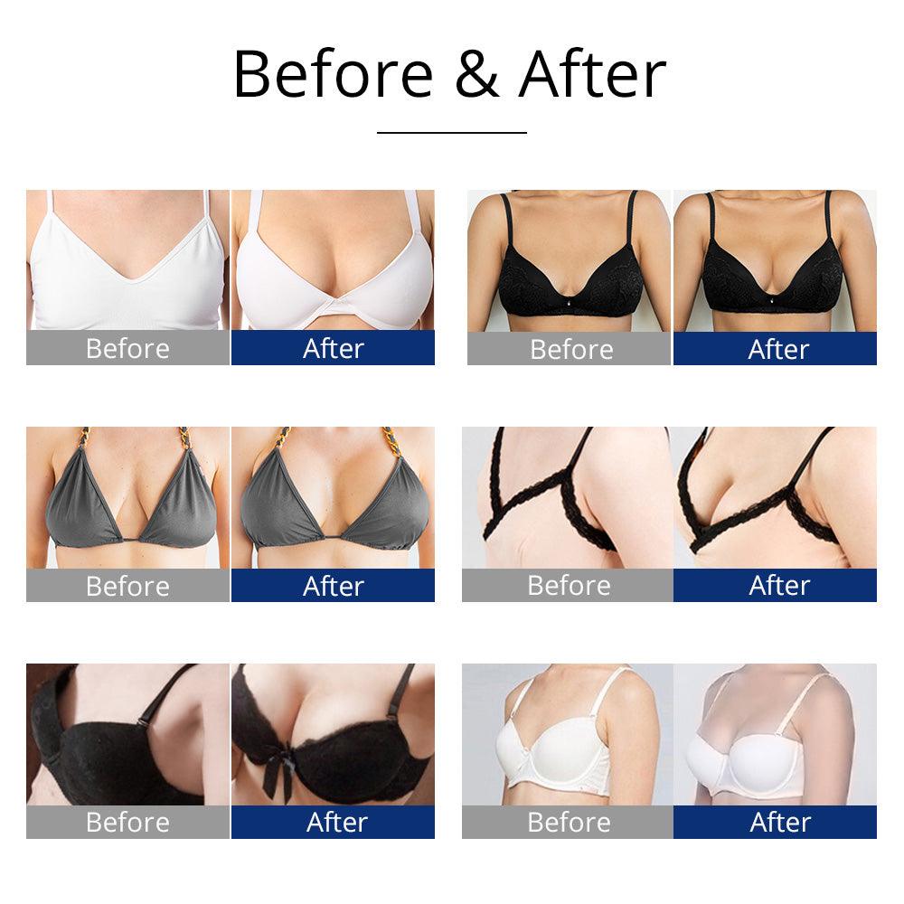 New Arrival Breast Enhancement Machine Vacuum Massage before & after