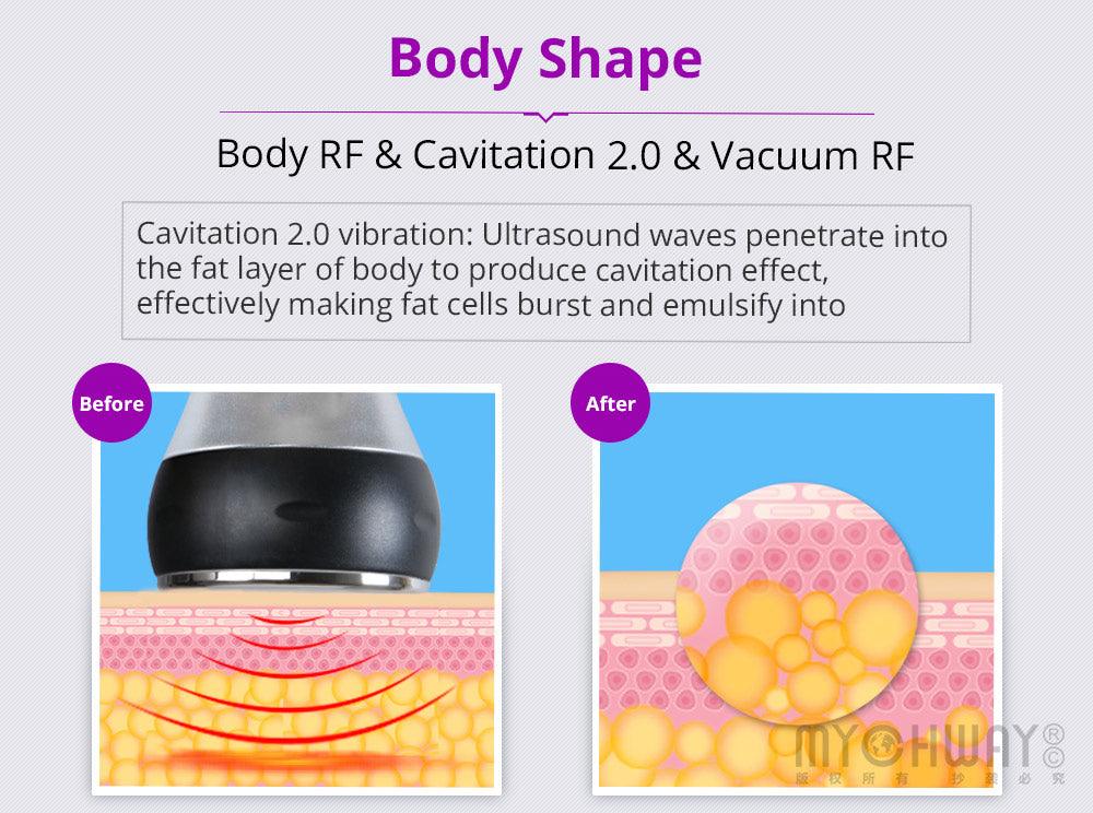 Radiofrequency Body Contouring Machine