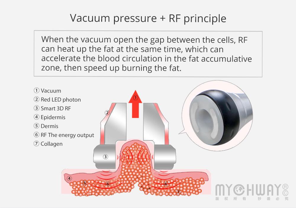 Radiofrequency Body Contouring Machine