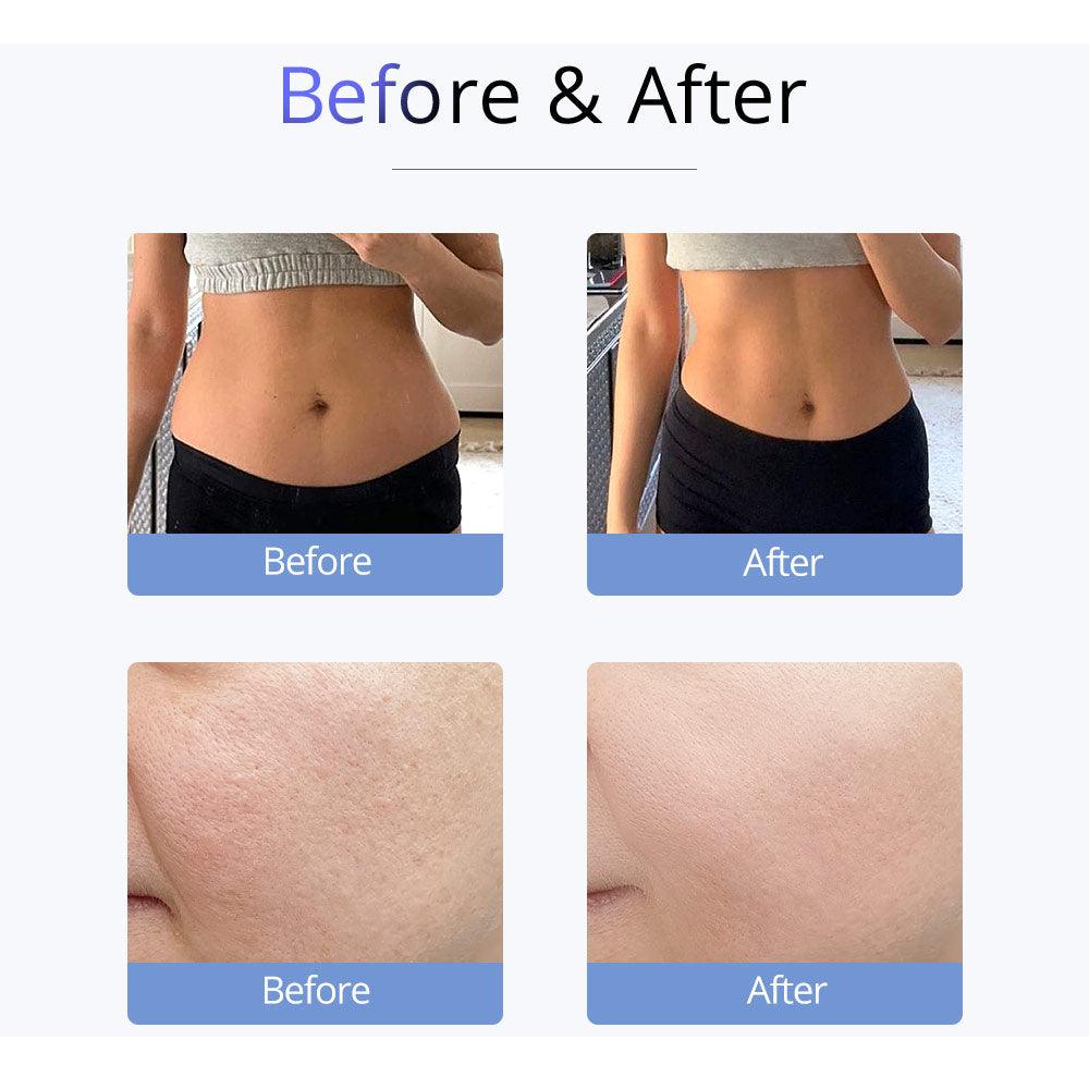 S Shape 30K Cavitation machine