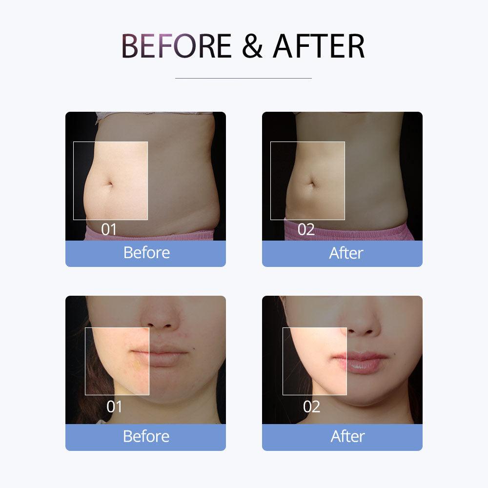 S Shape Body Care Machine after and before