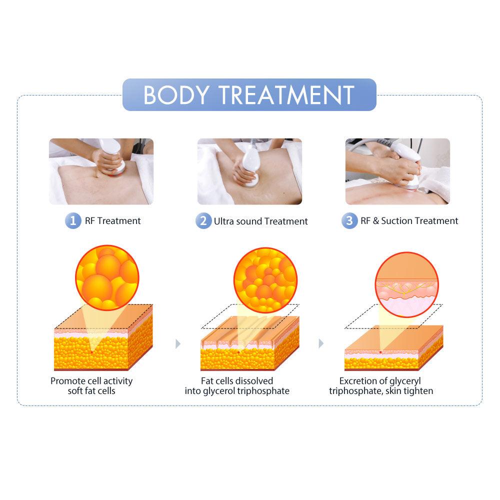 S Shape Body Sculpting Machine Body Treatment