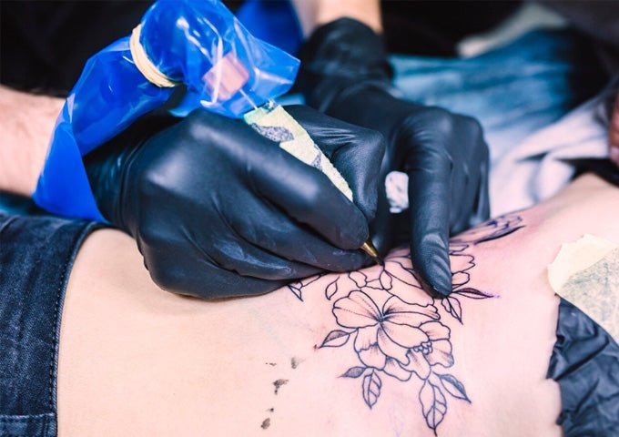 10 Benefits of Laser Tattoo Removal - myChway UK