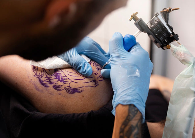 Tattoo Removal Side Effects and Risks