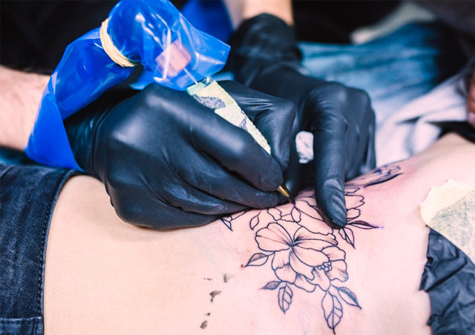 10 Benefits of Laser Tattoo Removal