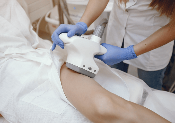 Laser Hair Removal Side Effects and Risks - myChway UK