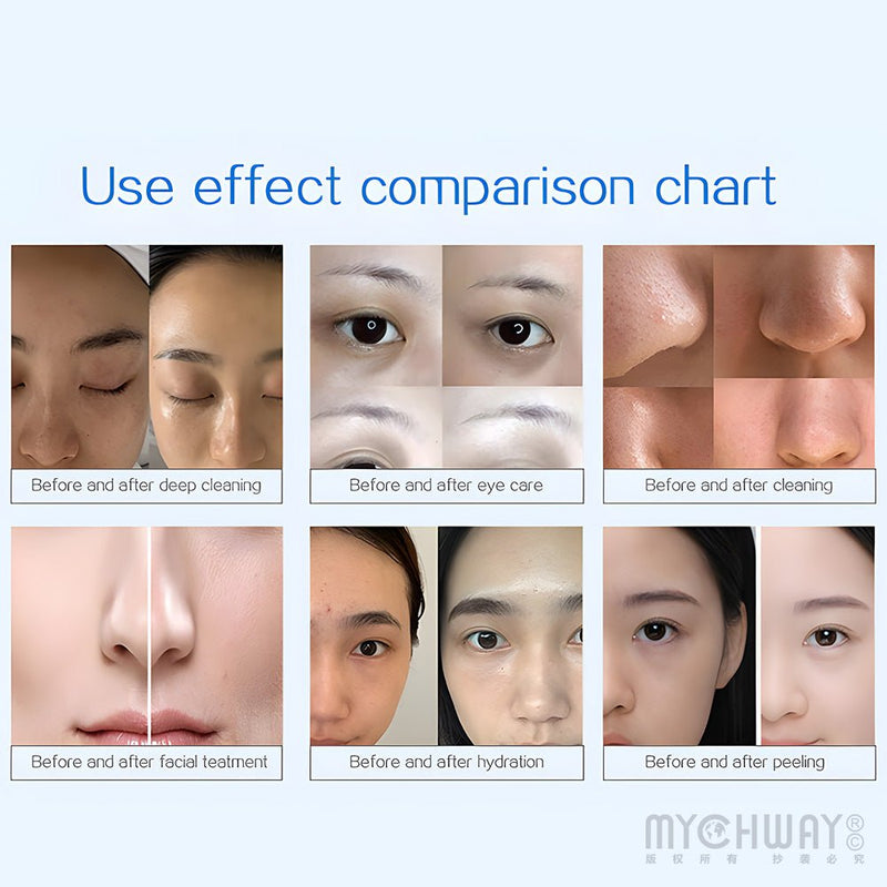 14 In 1 Hydra Diamond Dermabrasion Facial Beauty Machine For Skin Rejuvenation - myChway UK