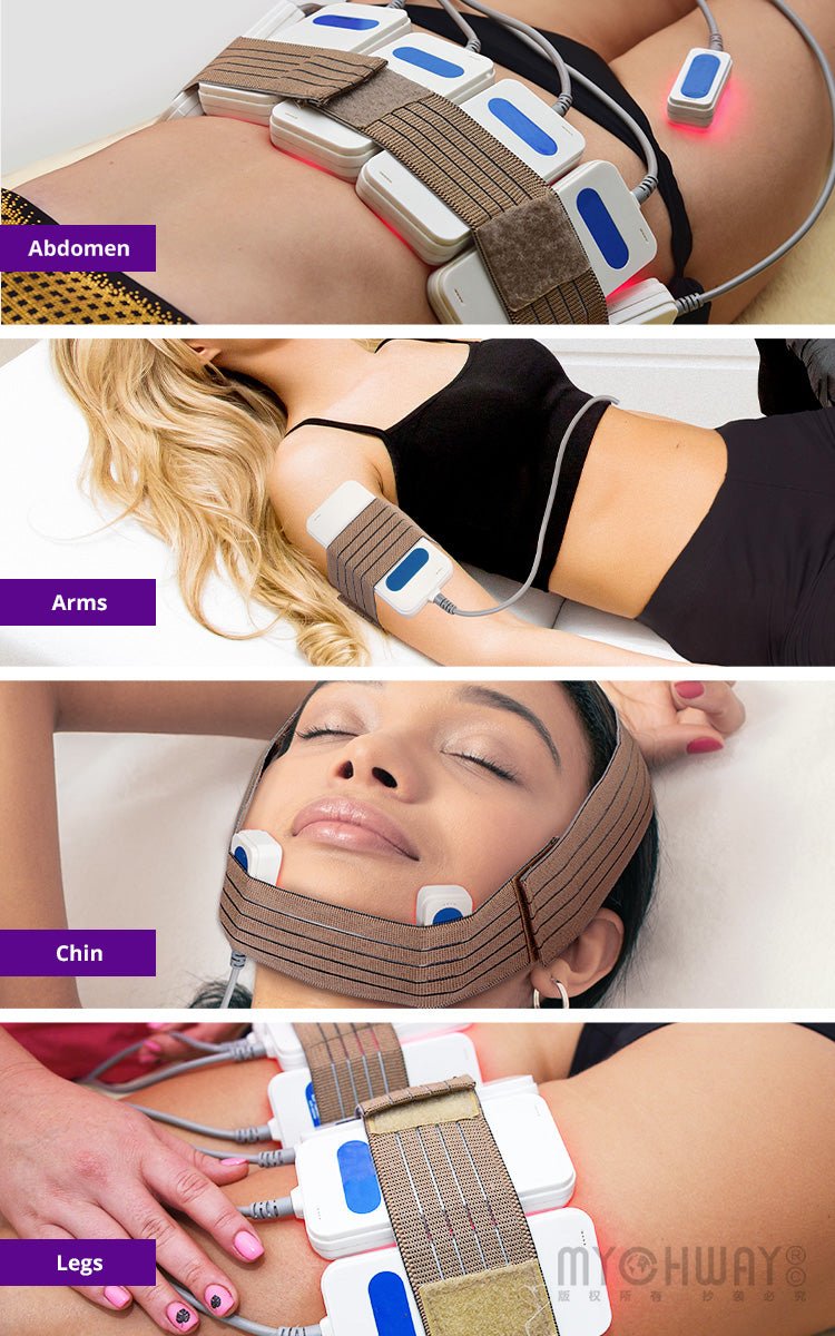 14 Pads Lipo Laser Fat Zapper - myChway UK