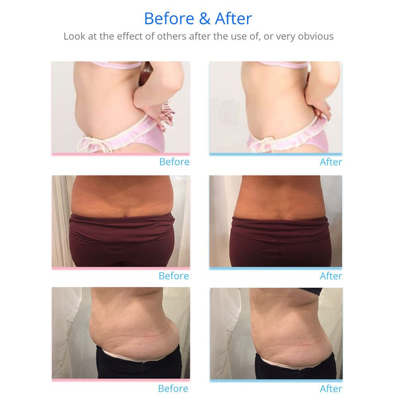 160mw LLLT LED Laser Machine 2.0 Weight Loss Fat Burning Removal 12 Big+4 Small Pads - myChway UK