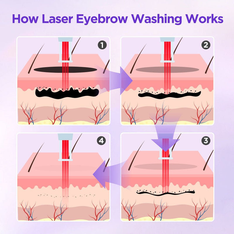 2-In-1 Picosecond 808 Diode Laser Machine For Hair Removal And Tattoo Removal - myChway UK