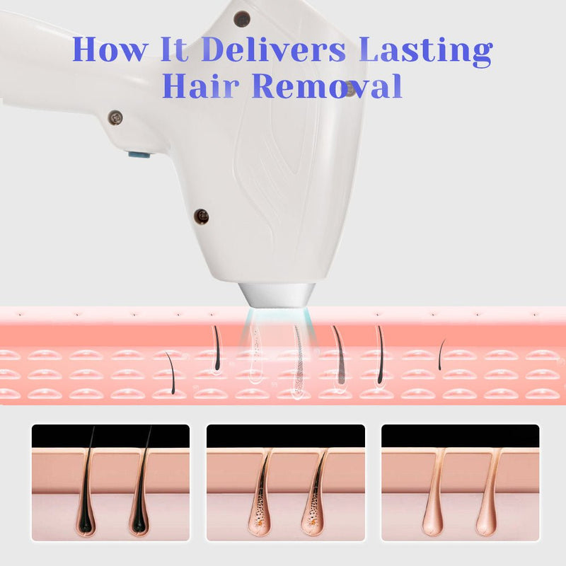 2 In1 DPT 808nm Diode Hair Removal YAG Laser Tattoo Removal Machine - myChway UK