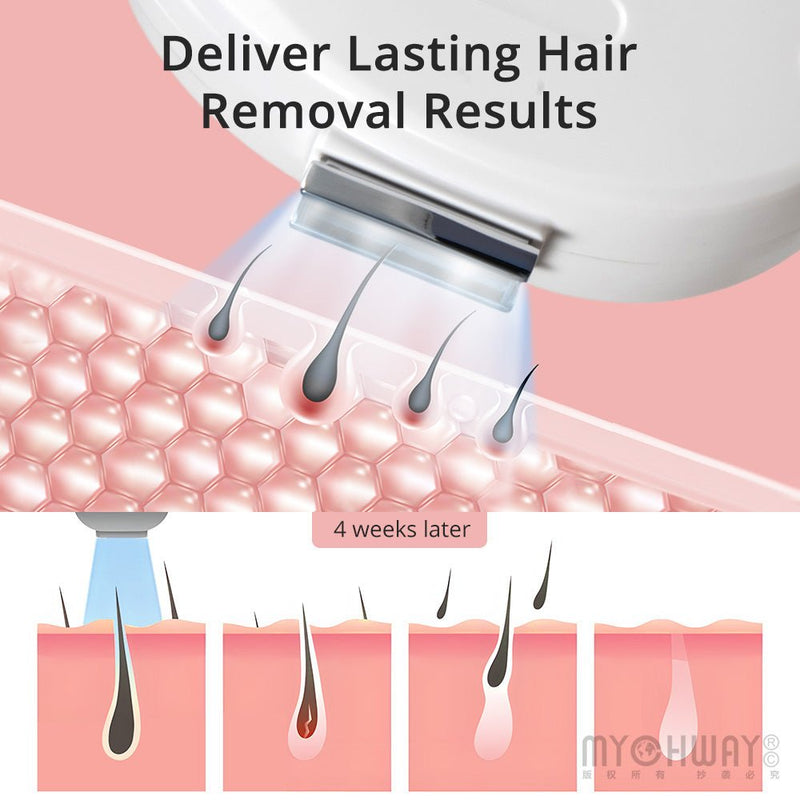 2000W SHR IPL Hair Remover E Light Skin Rejuvenation Beauty Machine With Filters - myChway UK