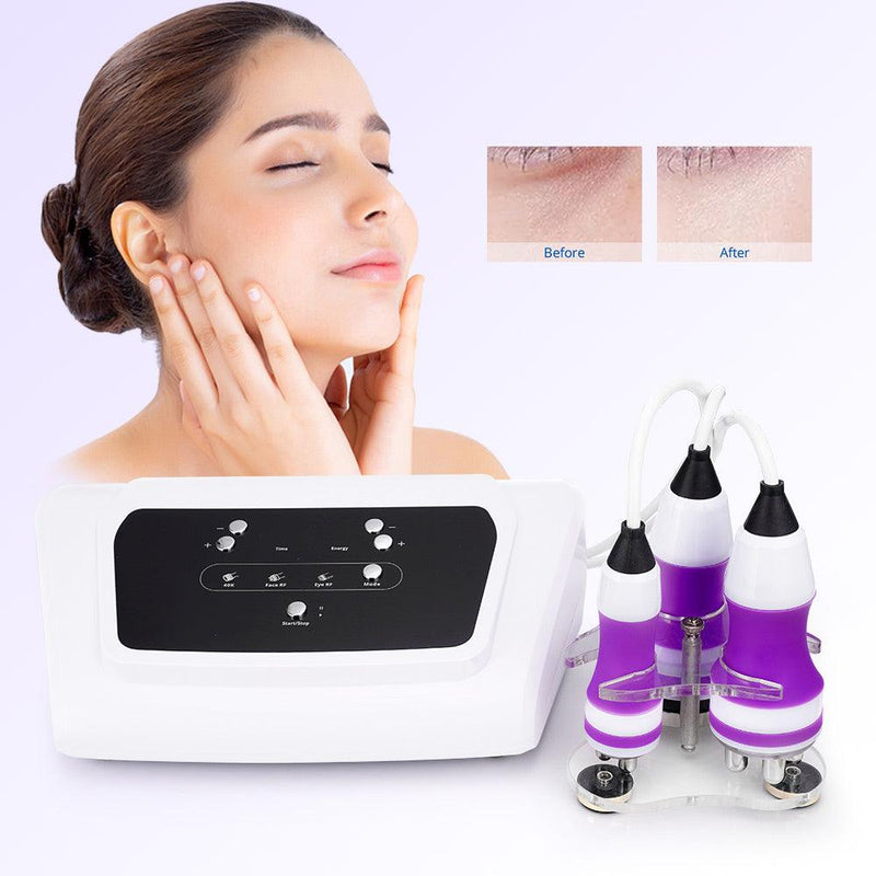 3 In 1 40K Ultrasonic Skin Tightening Machine - myChway UK