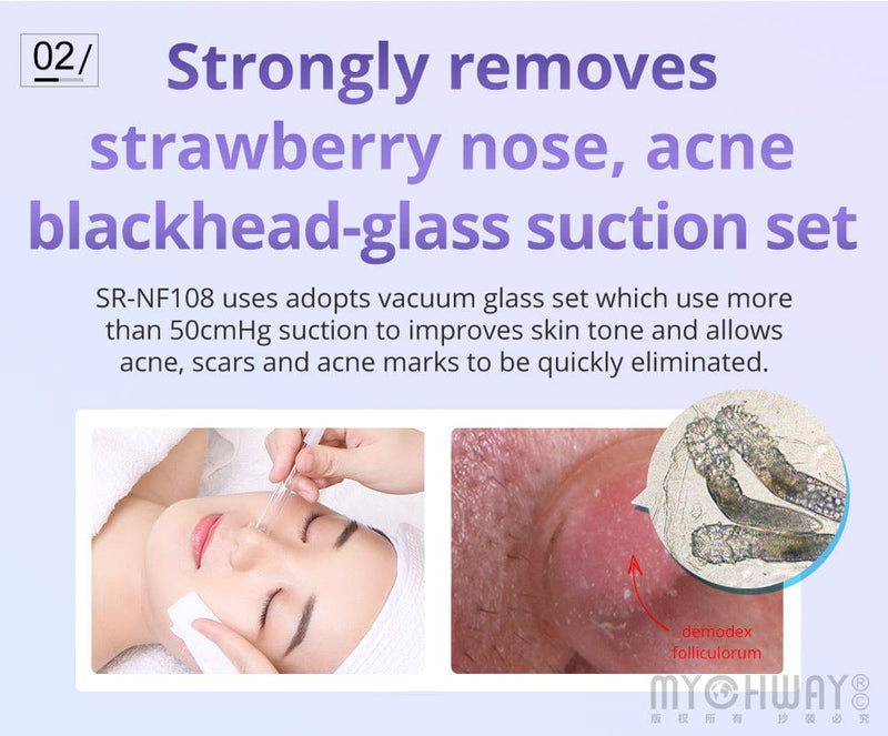 3 - IN - 1 Microdermabrasion Machine Skin Exfoliation Acne Removal - myChway UK