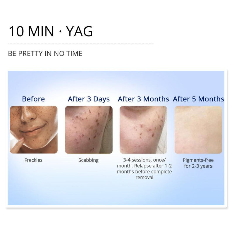 3 In 1 SHR Elight IPL Permanent Hair Removal Machine - myChway UK