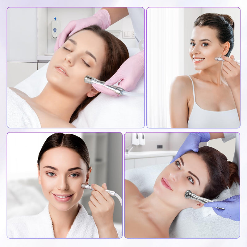 3 Wands & 9 Tips For Diamond Microdermabrasion Devices - myChway UK