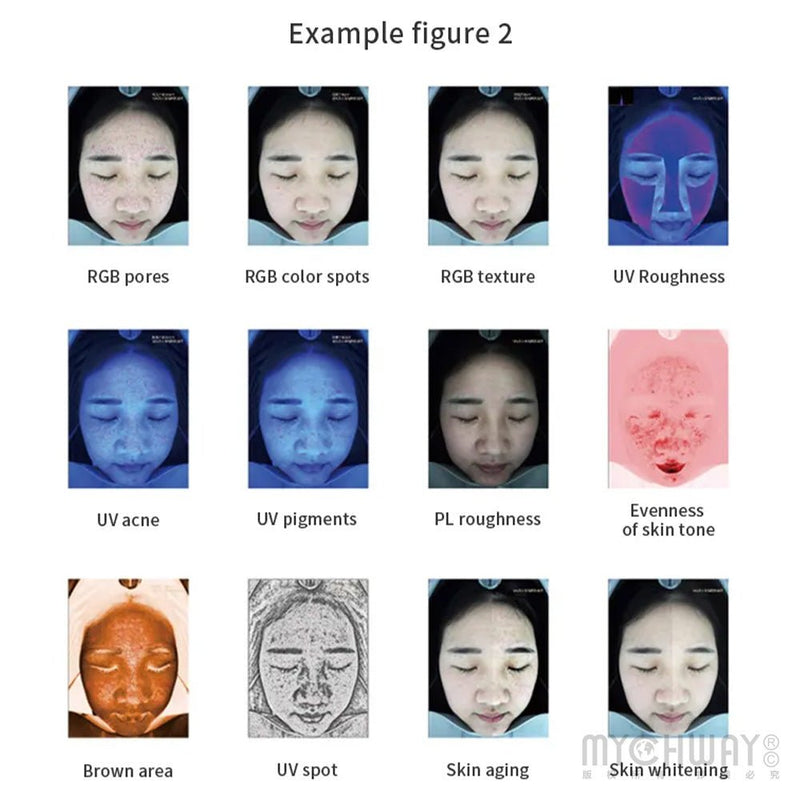 3D Intelligent Facial Skin Analyzer Machine - myChway UK