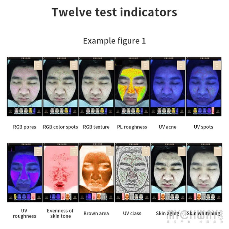 3D Intelligent Facial Skin Analyzer Machine - myChway UK