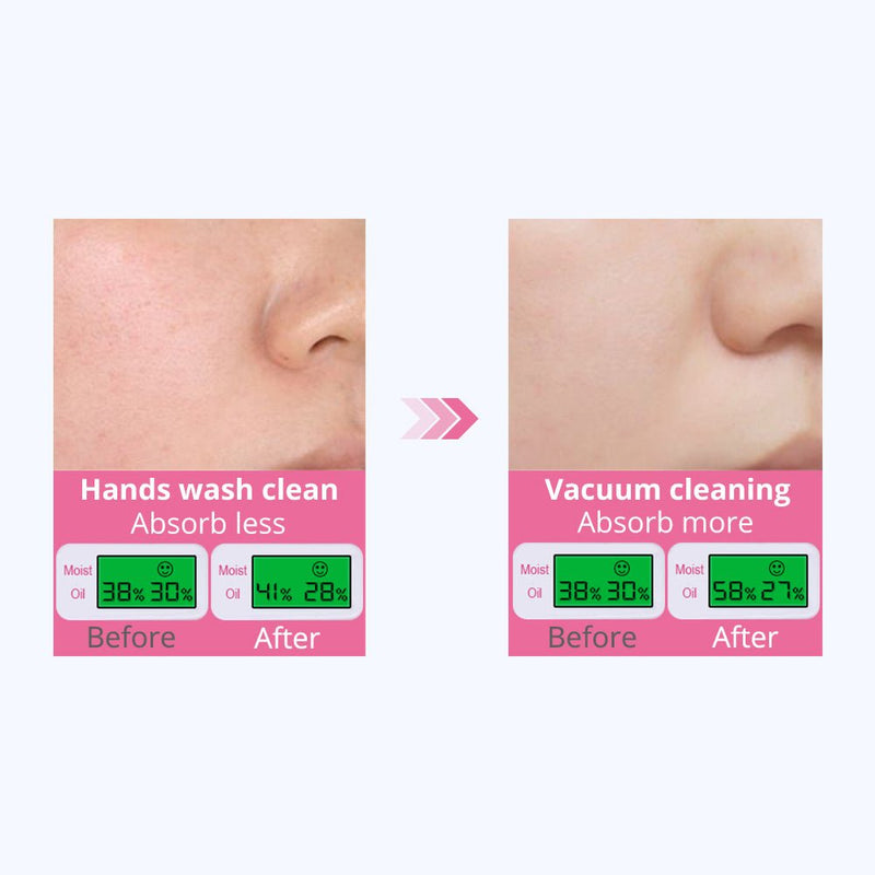 3in1 Hydro Microdermabrasion Machine For Skin Rejuvenation Cleansing Exfoliation - myChway UK