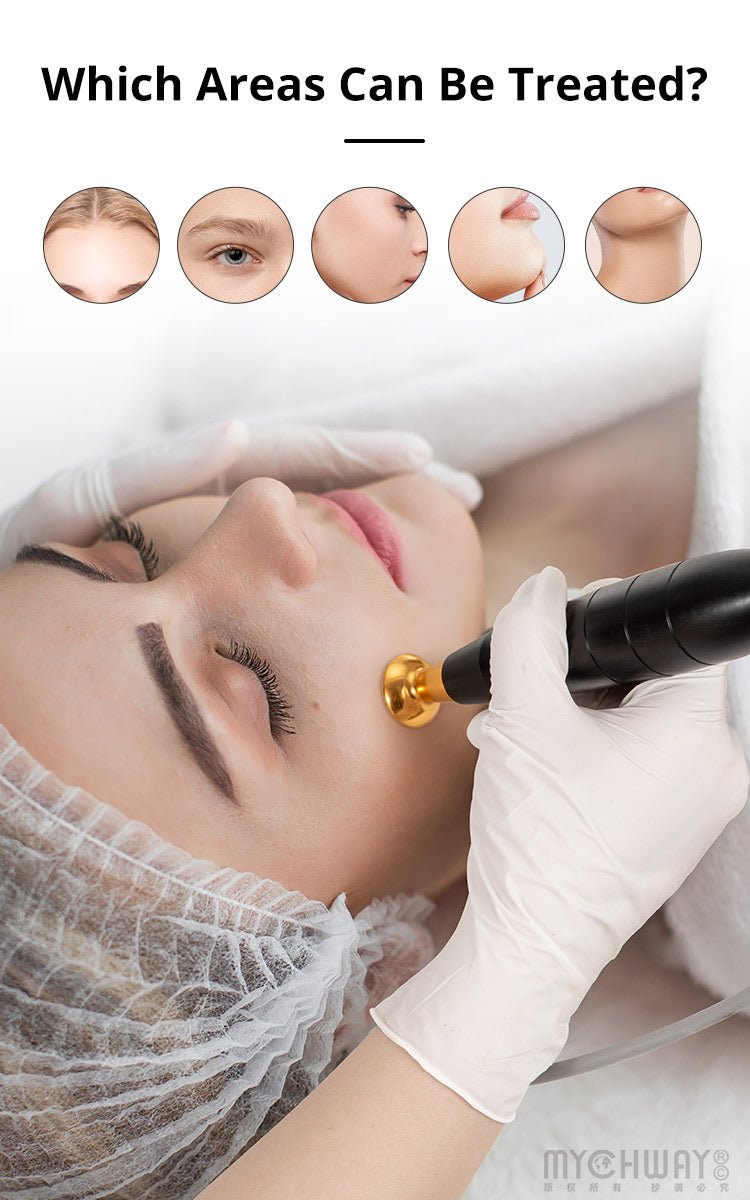 4 In 1 Plasma Facial Rejuvenation Machine For Mole Spot Removal - myChway UK
