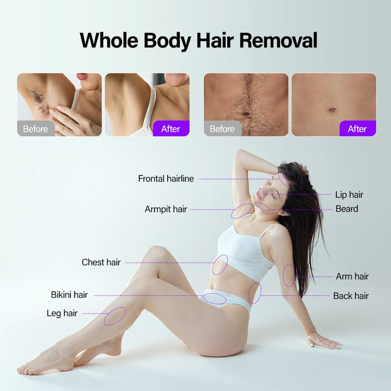 4 In 1 Professional Pico Laser Diode Hair Removal Skin Rejuvenation Machine - myChway UK