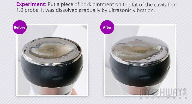 5 In 1 3 - polar Radiofrequency Body Contouring Machine - myChway UK