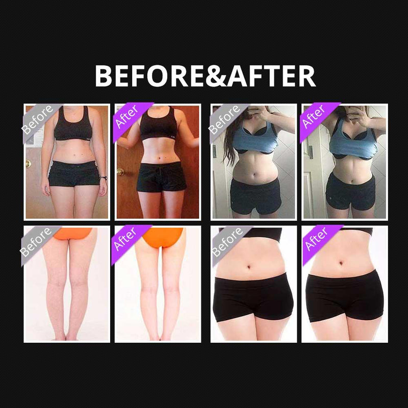 5 In 1 Cavitation Liposuction Machine - myChway UK