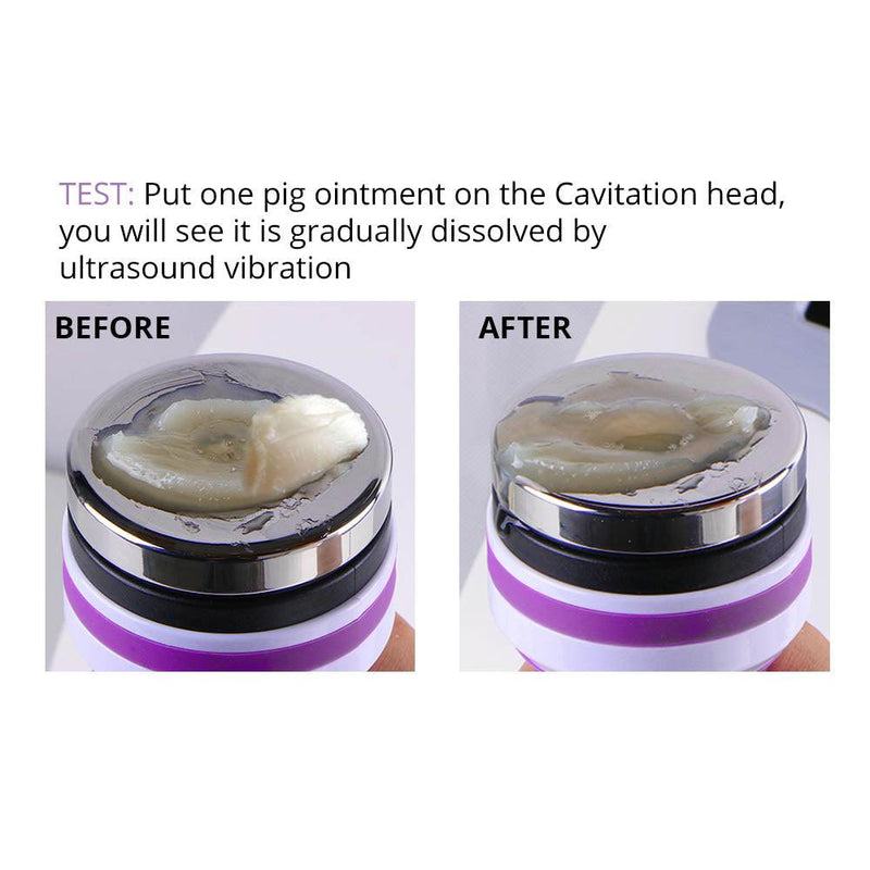 5 In 1 Cavitation Liposuction Machine - myChway UK