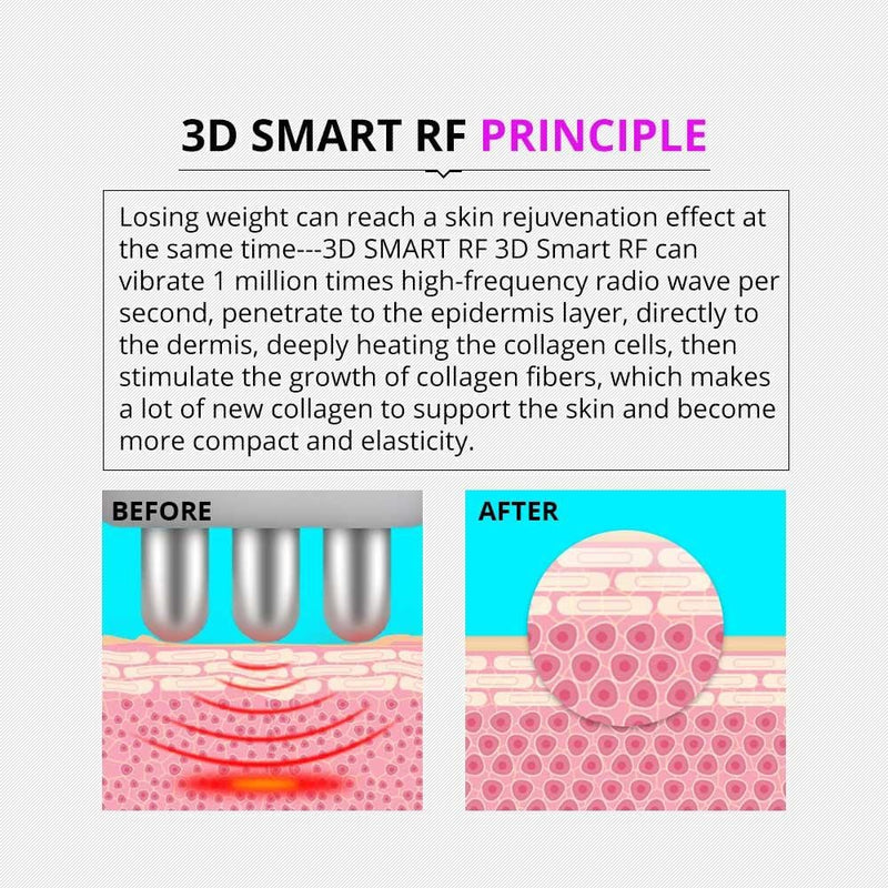 5 In 1 Cavitation Liposuction Machine - myChway UK