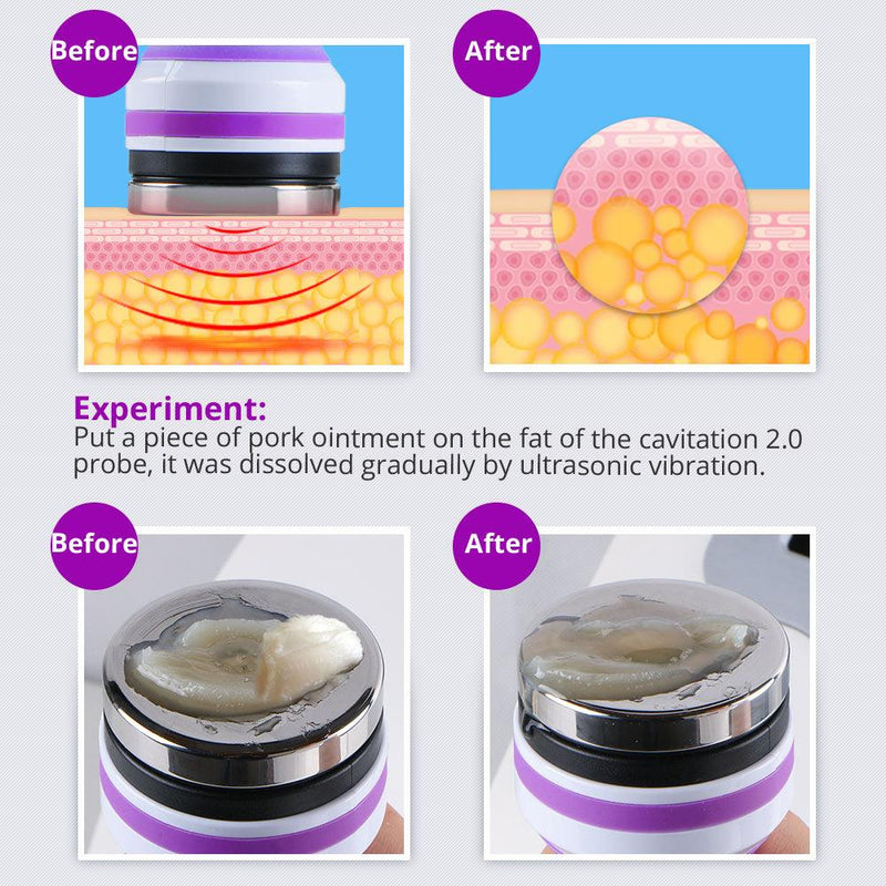 5 In 1 Vacuum Skin Lifting Cavi - Lipo Machine - myChway UK