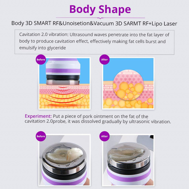 6 In 1 40K Cellulite Reduction Machine - myChway UK