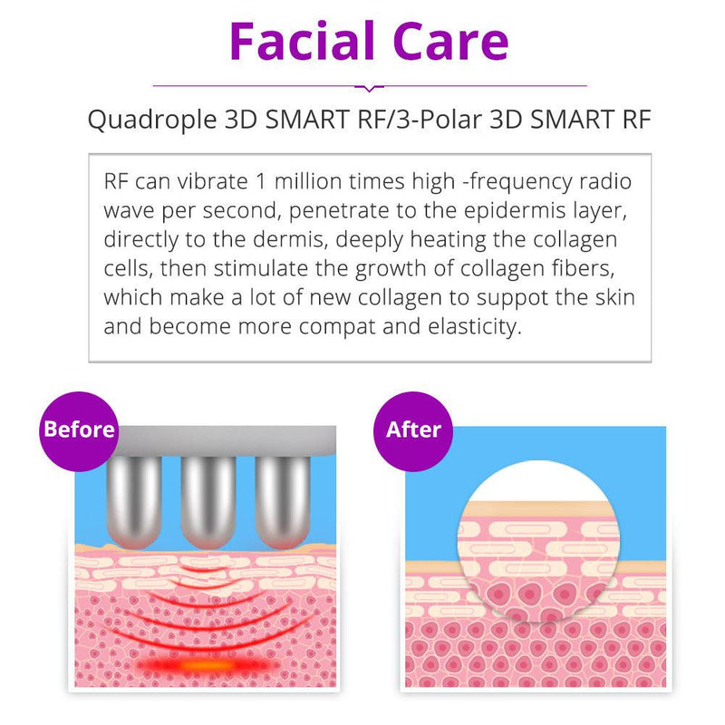 6 In 1 40K Cellulite Reduction Machine - myChway UK