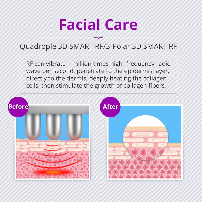 6 In 1 40K Ultrasonic Cavitation Device - myChway UK