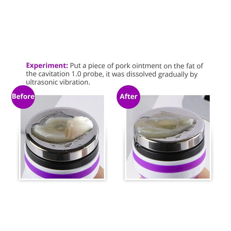 6 In 1 40K Ultrasonic Cavitation Device - myChway UK