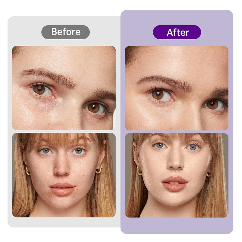 6 In 1 80k Cavitation Machine With Vacuum Radiofrequency For Body Contouring - myChway UK