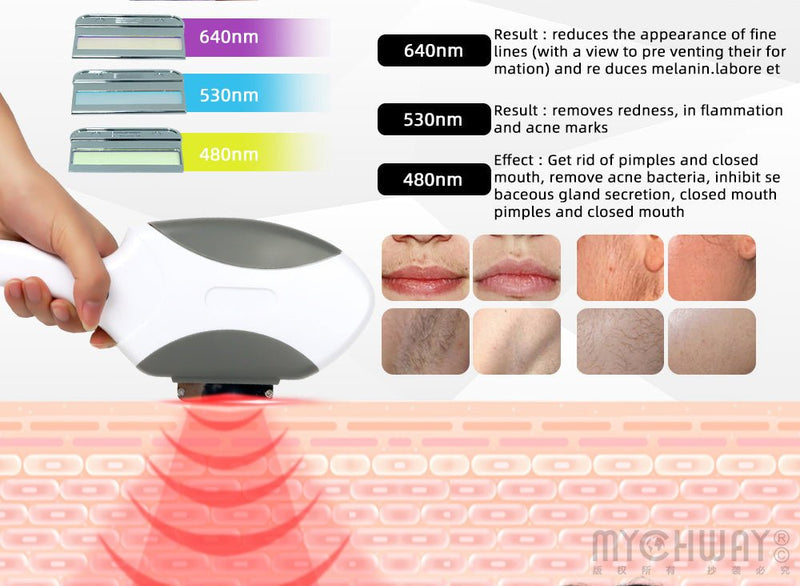 640/530/480nm Painless Diode Laser Hair Removal Machine For Face Whole Body - myChway UK