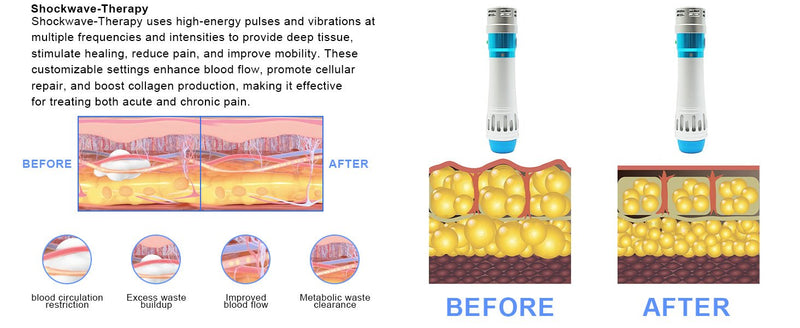 7 Heads Shockwave Therapy Machine for Pain Relief Deep Relaxation - myChway UK