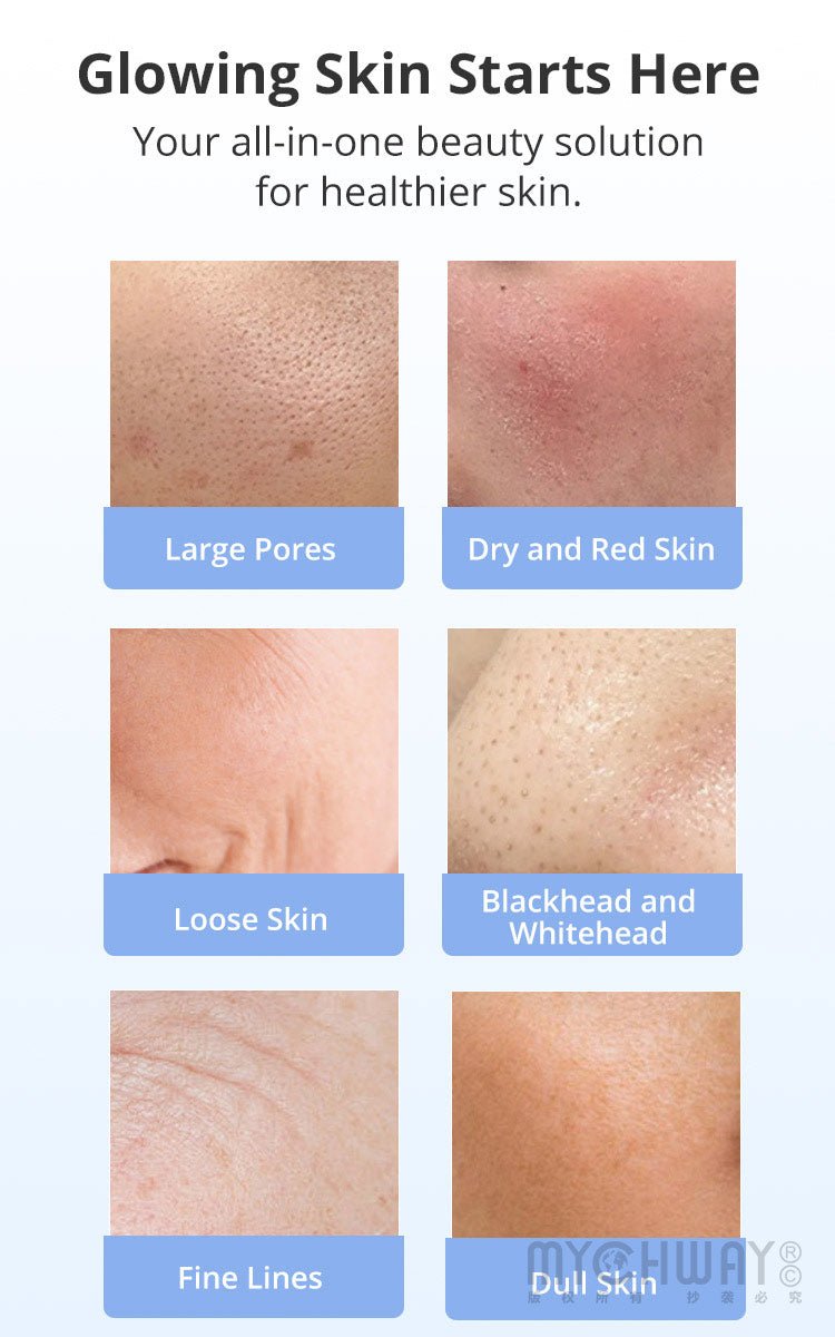 8 In 1 Hydro Dermabrasion EMS Ultrasonic Machine Facial Cleansing Lifting Device - myChway UK