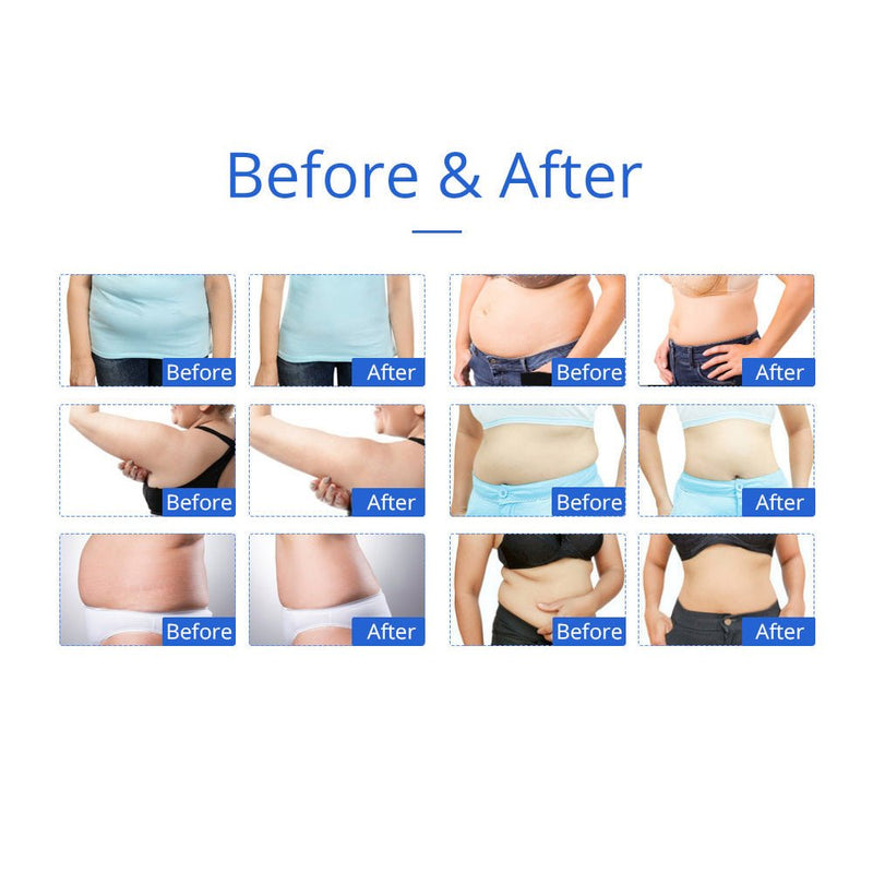 8 IN 1 Ultrasonic Cavitation Vacuum RF Microcurrent Body Slimming Laser Machine - myChway UK