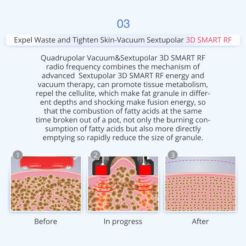 8 IN 1 Ultrasonic Cavitation Vacuum RF Microcurrent Body Slimming Laser Machine - myChway UK