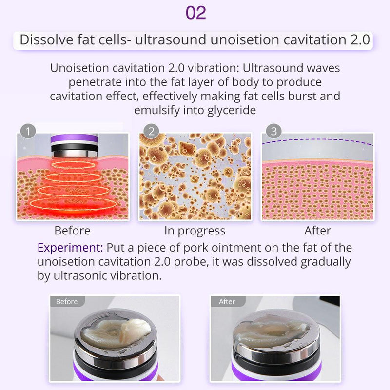 9 In 1 40K Vacuum Ultrasound Therapy Device - myChway UK
