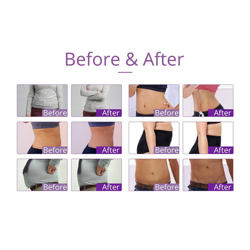 9 In 1 40K Vacuum Ultrasound Therapy Device - myChway UK