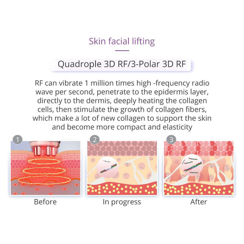 9 In 1 40K Vacuum Ultrasound Therapy Device - myChway UK