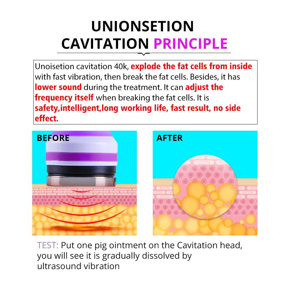 Cavitation Liposuction Machine