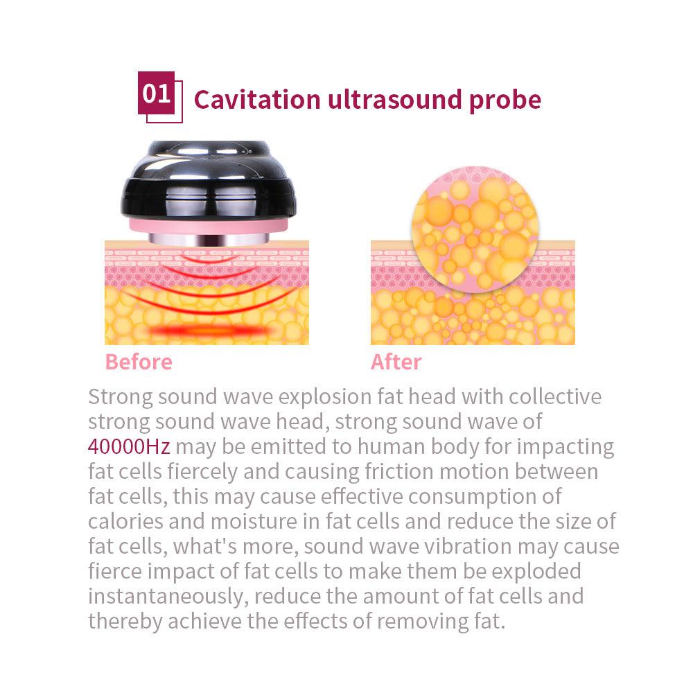 coolsculpting  machine