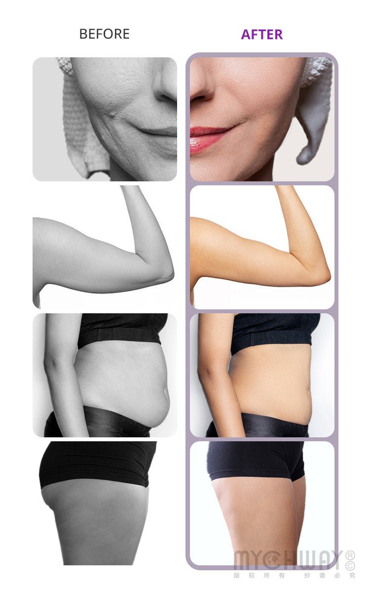 All in One Ultrasonic Cavitation Machine - myChway UK
